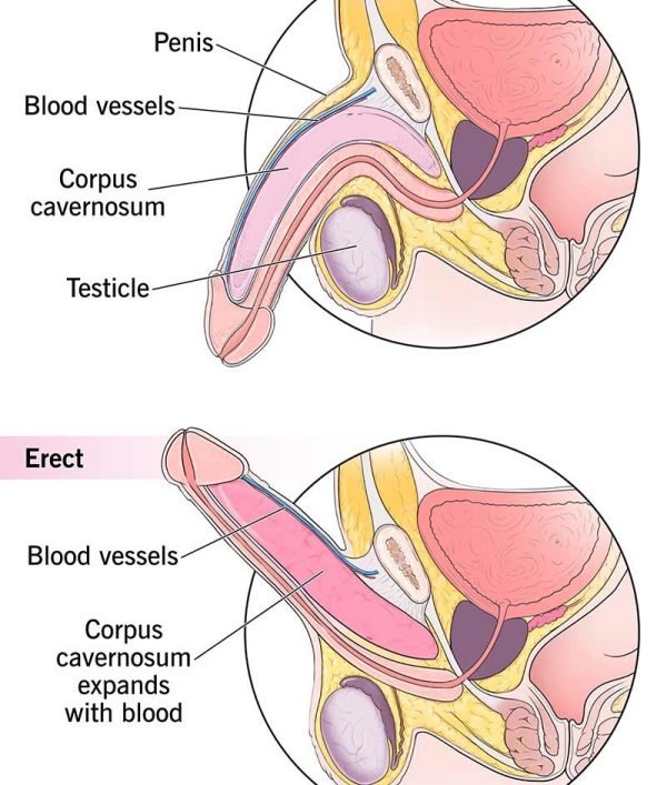 10035-erectile-dysfunction-1-600x707-1.jpg